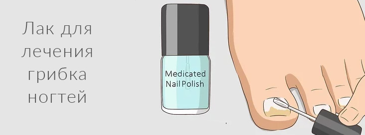 лак для лечения грибка ногтей